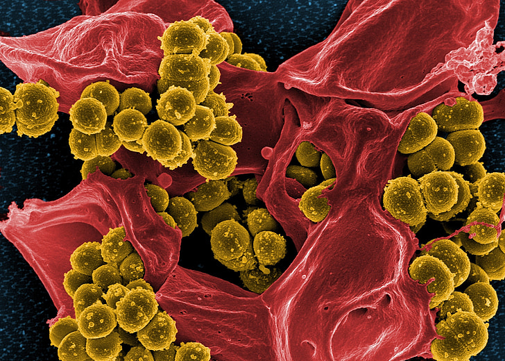 bacterial growth