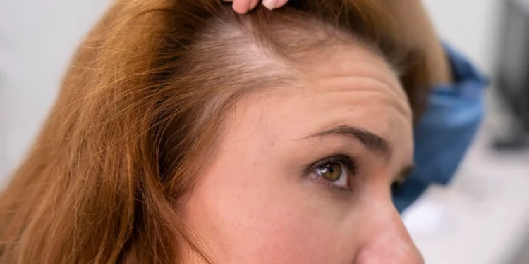 How to stop hair loss 7 reasons