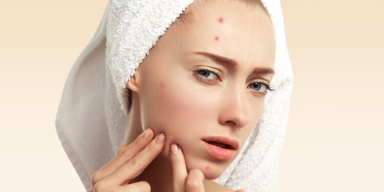 Close up isolated portrait of young woman squeezing pimple on her cheek in the bathroom. Cropped view of Caucasian female having skin problem, against blue wall background. Beauty and spa concept