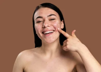 smiley-woman-showing-her-pimple-with-confidence